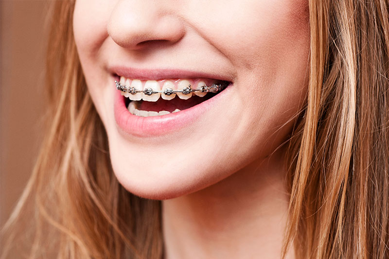 Orthodontics in Montebello